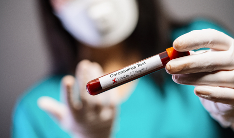 2019-nCoV Coronavirus. Positive Blood Sample in Doctors Hand. Respiratory Syndrome. Coronavirus outbreaking : Stock Photo or Stock Video Download rcfotostock photos, images and assets rcfotostock | RC-Photo-Stock.: