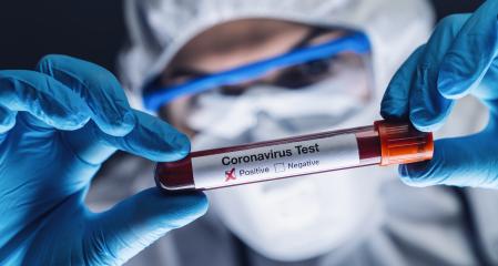2019-nCoV Coronavirus. Positive Blood Sample in Doctors Hand. Respiratory Syndrome. Coronavirus outbreaking- Stock Photo or Stock Video of rcfotostock | RC-Photo-Stock