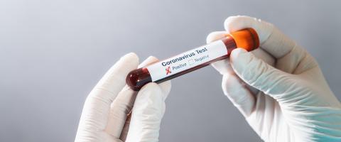 2019-nCoV Coronavirus. Positive Blood Sample in Doctors Hand with gloves. Respiratory Syndrome. Coronavirus outbreaking- Stock Photo or Stock Video of rcfotostock | RC Photo Stock