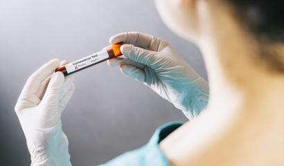 Corona Virus test in Lab. Scientist hold positive Blood Test. New Epidemic Coronavirus 2019 nCoV- Stock Photo or Stock Video of rcfotostock | RC Photo Stock