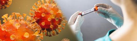 Corona Virus test in Lab. Scientist hold positive Blood Test. New Epidemic Coronavirus 2019 nCoV. Coronavirus outbreaking, banner size- Stock Photo or Stock Video of rcfotostock | RC Photo Stock