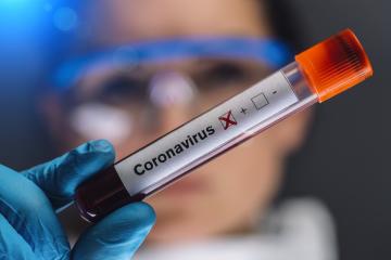 Coronavirus 2019-nCoV Blood Sample. Corona virus outbreaking. Corona Virus in Lab. Scientist hold a tube with Blood Test awith the Virus. Epidemic Corona Virus- Stock Photo or Stock Video of rcfotostock | RC Photo Stock