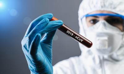 Coronavirus COVID 19 nCov Outbreak. medical or scientific holding Corona Virus Blood Test Tube from Patient. Positive Case of Korona Virus Europe, Italy, Wuhan, China. Epidemic and Pandemic infection  : Stock Photo or Stock Video Download rcfotostock photos, images and assets rcfotostock | RC Photo Stock.: