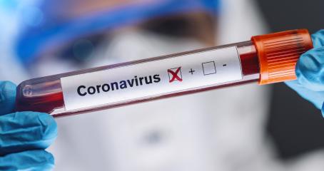 Coronavirus COVID-19 Infected Blood Sample in Doctor Scientist Hands. Epidemic and Virus Outbreak.- Stock Photo or Stock Video of rcfotostock | RC Photo Stock