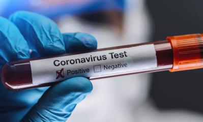 doctor or nurse in protective suit and face shield holding a positive blood test result for coronavirus or covid-19.- Stock Photo or Stock Video of rcfotostock | RC Photo Stock