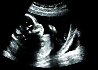 Ultrasound ofa baby in mother's womb : Stock Photo or Stock Video Download rcfotostock photos, images and assets rcfotostock | RC Photo Stock.: