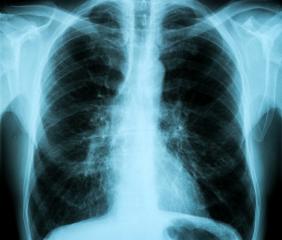 X-Ray Image of Human Healthy Chest MRI- Stock Photo or Stock Video of rcfotostock | RC Photo Stock