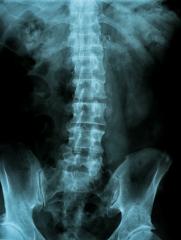 X-ray image of the pelvis and spinal column- Stock Photo or Stock Video of rcfotostock | RC-Photo-Stock