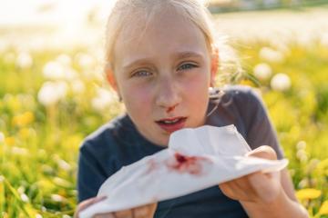 young girl with a nosebleed holds a tissue with blood stains. She looks distressed, standing in a field with a blurred background of dandelions, highlighting the health concern and discomfort. : Stock Photo or Stock Video Download rcfotostock photos, images and assets rcfotostock | RC Photo Stock.: