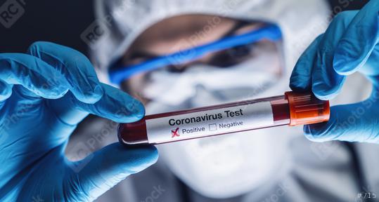 2019-nCoV Coronavirus. Positive Blood Sample in Doctors Hand. Respiratory Syndrome. Coronavirus outbreaking  : Stock Photo or Stock Video Download rcfotostock photos, images and assets rcfotostock | RC Photo Stock.: