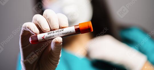 2019-nCoV Coronavirus. Positive Blood Sample in Doctors Hand with gloves. Respiratory Syndrome. Coronavirus outbreaking  : Stock Photo or Stock Video Download rcfotostock photos, images and assets rcfotostock | RC Photo Stock.: