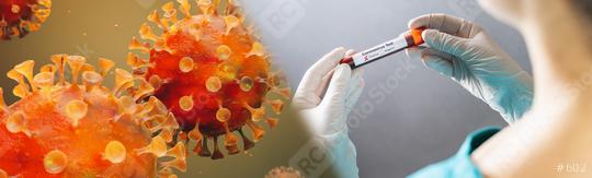 Corona Virus test in Lab. Scientist hold positive Blood Test. New Epidemic Coronavirus 2019 nCoV. Coronavirus outbreaking, banner size  : Stock Photo or Stock Video Download rcfotostock photos, images and assets rcfotostock | RC Photo Stock.: