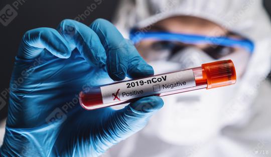Coronavirus 2019-nCoV Blood Sample. Corona virus outbreaking. Corona Virus in Lab. Scientist hold a tube with Blood Test awith the Virus. New Epidemic Corona Virus - Buy at rcfotostock this photo and