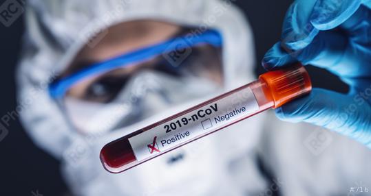 Coronavirus COVID 19 nCov Outbreak. New Corona Virus Blood Test Tube from Patient. Positive Case of Korona Virus Europe, Italy, Wuhan, China. Epidemic and Pandemic infection  : Stock Photo or Stock Video Download rcfotostock photos, images and assets rcfotostock | RC-Photo-Stock.: