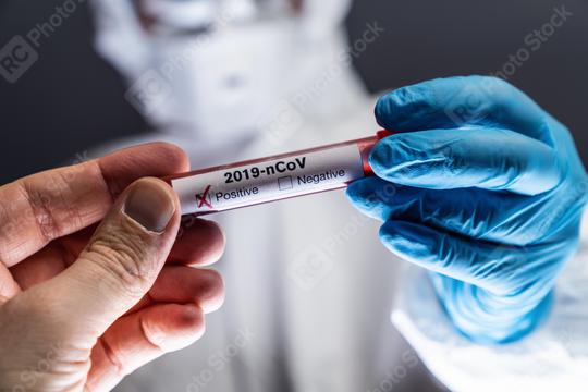 Coronavirus Test 2019-nCoV Hand give Positive Blood test to a Scientist. Corona virus outbreaking. Epidemic virus Respiratory Syndrome. China  : Stock Photo or Stock Video Download rcfotostock photos, images and assets rcfotostock | RC Photo Stock.: