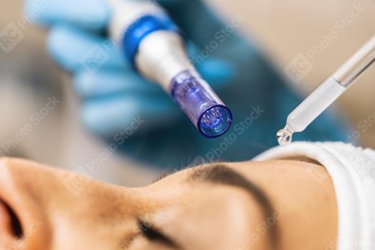 Cosmetician makes microneedling, care to the patient using derma  : Stock Photo or Stock Video Download rcfotostock photos, images and assets rcfotostock | RC Photo Stock.: