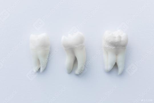 dentist teeths wisdom tooths   : Stock Photo or Stock Video Download rcfotostock photos, images and assets rcfotostock | RC Photo Stock.: