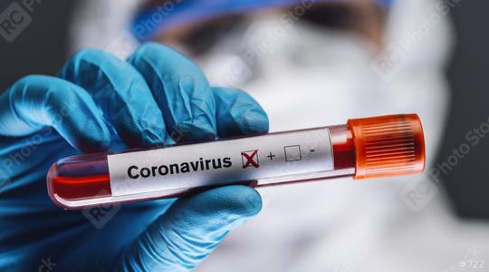 doctor or nurse in protective suit and face shield holding a positive blood test result for coronavirus or covid-19  : Stock Photo or Stock Video Download rcfotostock photos, images and assets rcfotostock | RC Photo Stock.: