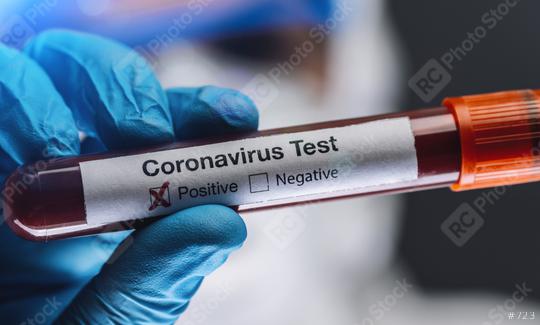 doctor or nurse in protective suit and face shield holding a positive blood test result for coronavirus or covid-19.  : Stock Photo or Stock Video Download rcfotostock photos, images and assets rcfotostock | RC Photo Stock.: