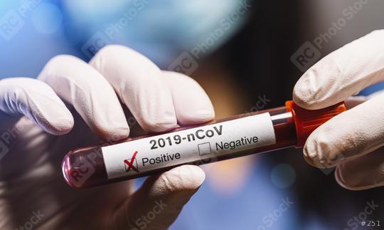 Female chemist or nurse hand in white protective gloves hold test tube closeup background  : Stock Photo or Stock Video Download rcfotostock photos, images and assets rcfotostock | RC Photo Stock.: