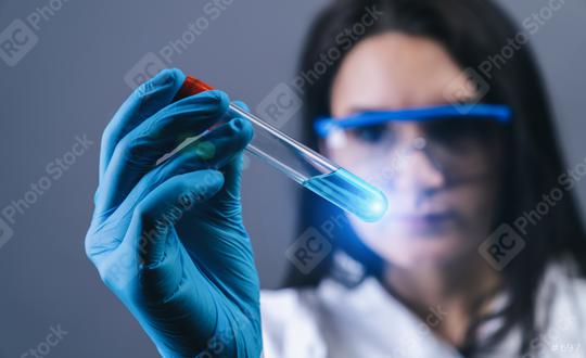 female medical lab worker holding 2019-nCoV Coronavirus Test tube. Positive Blood Sample in Scientist Hand. Coronavirus outbreaking  : Stock Photo or Stock Video Download rcfotostock photos, images and assets rcfotostock | RC Photo Stock.: