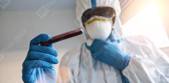 Medic in protective clothing with blood sample for Covid-19 test for antibodies in the laboratory  : Stock Photo or Stock Video Download rcfotostock photos, images and assets rcfotostock | RC Photo Stock.: