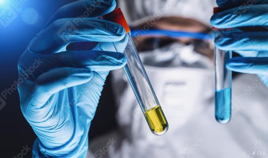 medical scientist holds test tubes with Coronavirus 2019-nCoV vaccination in the development at the lab. Virus concept. Coronavirus outbreaking concept image  : Stock Photo or Stock Video Download rcfotostock photos, images and assets rcfotostock | RC Photo Stock.: