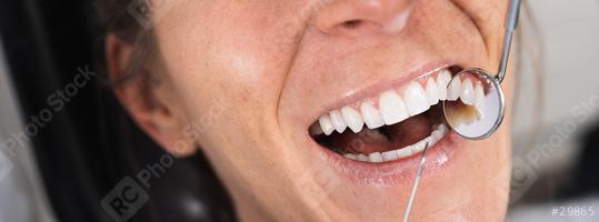 Smiling pretty woman having her teeth examined by dentist in clinic. Banner size  : Stock Photo or Stock Video Download rcfotostock photos, images and assets rcfotostock | RC Photo Stock.: