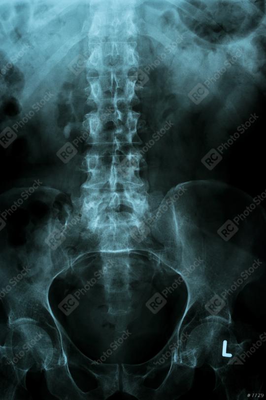 spine and pelvis of a human body on x-ray image  : Stock Photo or Stock Video Download rcfotostock photos, images and assets rcfotostock | RC Photo Stock.: