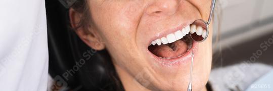 Teeth health concept. Cropped photo of smiling woman mouth under treatment at dental clinic, banner size  : Stock Photo or Stock Video Download rcfotostock photos, images and assets rcfotostock | RC Photo Stock.: