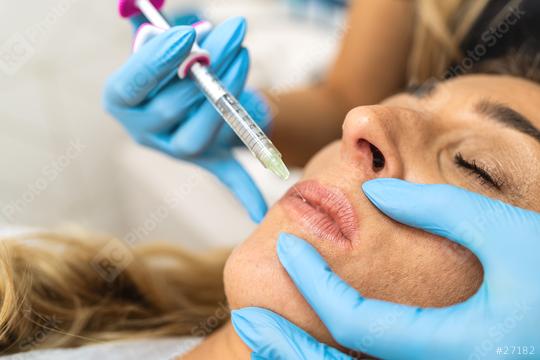 The doctor cosmetologist makes Lip augmentation procedure of a beautiful woman in a beauty salon. Cosmetology skin care.  : Stock Photo or Stock Video Download rcfotostock photos, images and assets rcfotostock | RC Photo Stock.: