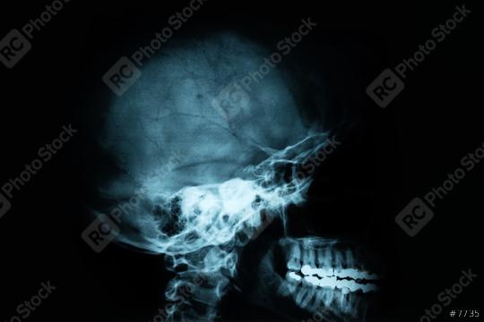 X-Ray Image Of Human Skull  : Stock Photo or Stock Video Download rcfotostock photos, images and assets rcfotostock | RC Photo Stock.: