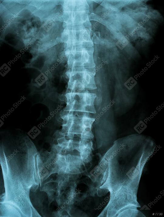 X-ray image of the pelvis and spinal column  : Stock Photo or Stock Video Download rcfotostock photos, images and assets rcfotostock | RC Photo Stock.: