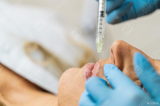 young woman gets injection of Anti-aging face treatment in her l  : Stock Photo or Stock Video Download rcfotostock photos, images and assets rcfotostock | RC Photo Stock.: